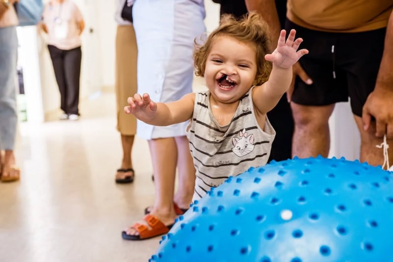 A toddler affected by cleft conditions plays with a ball prior to reconstructive surgery in northeastern Brazil in early 2025.