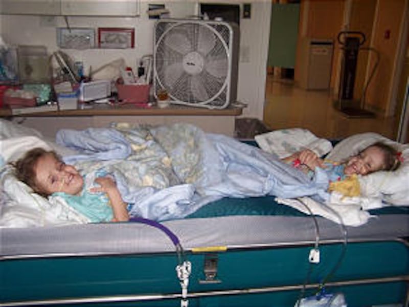 While recovering from separation surgery, formerly conjoined twins Maliyah and Kendra Herrin share a