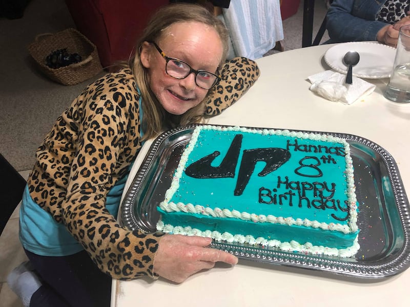 Hanna Barrott has a condition called lamellar ichthyosis. Despite life’s obstacles, Hanna has proven that her conditions do not define who she is and that her faith is much deeper than her skin.